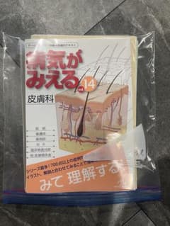 裁断済み　病気がみえる vol.14のサムネイル