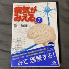 病気がみえる vol.7 脳・神経のサムネイル