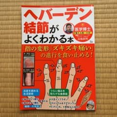ヘバーデン結節がよくわかる本 「指の変形」「ズキズキ痛い」の進行を食い止める!のサムネイル