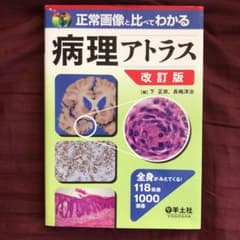 正常画像と比べてわかる病理アトラス : 全身がみえてくる!118疾患1000画像のサムネイル