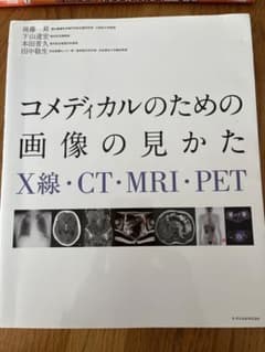 コメディカルのための画像の見かた : X線・CT・MRI・PETのサムネイル