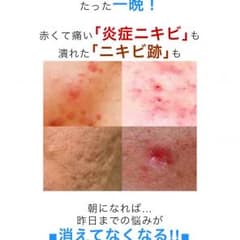 エミオネのサムネイル