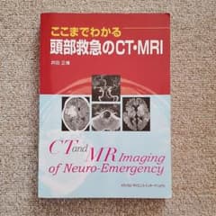 ここまでわかる頭部救急のCT・MRI