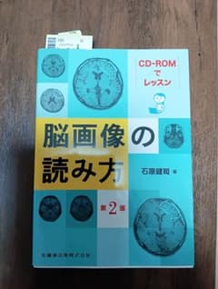 CD-ROMでレッスン脳画像の読み方【第2版】のサムネイル