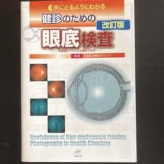 手にとるようにわかる健診のための眼底検査 : 無散瞳カメラによる撮影と判定 手にとるようにわかる健診のための眼底検査 : 無散瞳カメラによる撮影