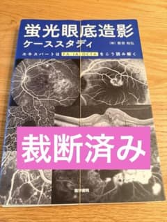 蛍光眼底造影ケーススタディ FAIAOCTA 眼科 裁断済み - メルカリ
