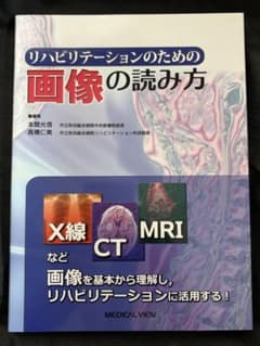 リハビリテーションのための画像の読み方のサムネイル