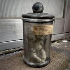 シャム双生児標本のサムネイル