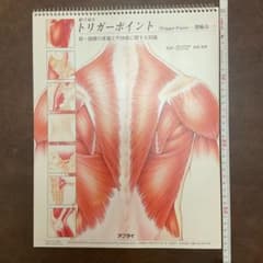 絵で見るトリガーポイントのサムネイル