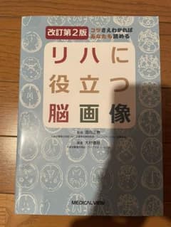コツさえわかればあなたも読める リハに役立つ脳画像のサムネイル