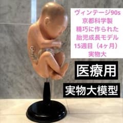 90s京都科学製精巧に作られた胎児成長モデル 15週目（4ヶ月）実物大 精巧模型 m75127054450_1.jpg?1775375337