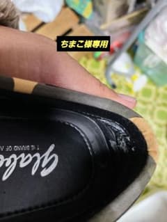 踵のところに見てください。凄くボロボロなってます。99999999999のサムネイル