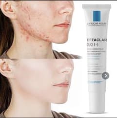 ラロッシュポゼ Effaclar duo+/30mlのサムネイル