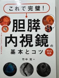 【裁断済み】これで完璧!胆膵内視鏡の基本とコツのサムネイル