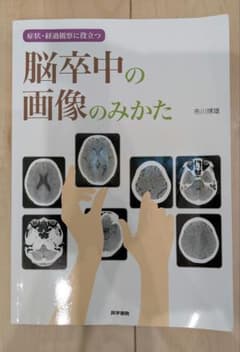 脳卒中の画像のみかた 症状・経過観察に役立つのサムネイル