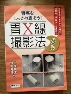 胃X線撮影法 虎の巻 胃癌をしっかり表そう！ 〔書き込みなし〕のサムネイル