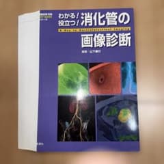 裁断済み　画像診断別冊　わかる!役立つ!消化管の画像診断のサムネイル
