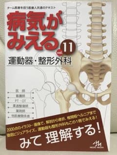 病気がみえる vol.11 運動器・整形外科のサムネイル