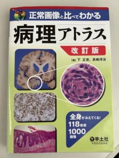 正常画像と比べてわかる病理アトラス : 全身がみえてくる!118疾患1000画像のサムネイル