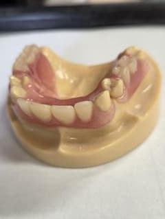 ノンクラス デンチャー サンプル 模型のサムネイル