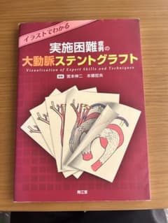 実施困難症例の大動脈ステントグラフトのサムネイル