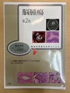 脳腫瘍のサムネイル