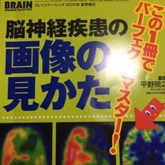 この1冊でパーフェクトマスター!脳神経疾患の画像の見かた ブレインナーシング …のサムネイル