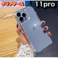 ∀ 튼튼한 케이스 ∀ 아이폰 11pro 케이스 한국 인기 세련된 클리어 케이스 투명