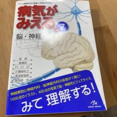 病気がみえる vol.7 (脳・神経)のサムネイル