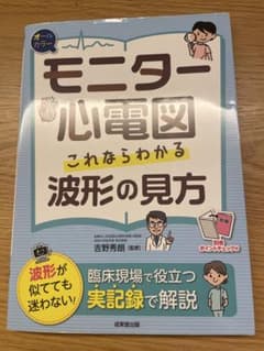 モニター心電図 これならわかる波形の見方のサムネイル
