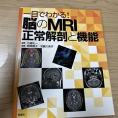 一目でわかる!脳のMRI正常解剖と機能のサムネイル