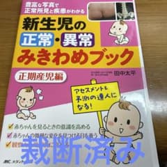 新生児の正常・異常みきわめブック 豊富な写真で正常所見と疾患がわかる 正期産児編のサムネイル