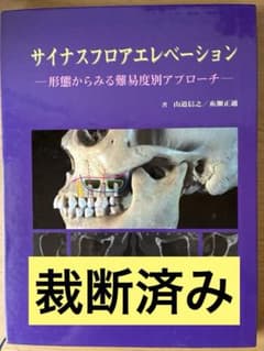 【裁断済み】サイナスフロアエレベーションアルティメットガイド 裁断済】サイナスフロアエレベーション : 形態からみる難易度別