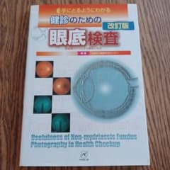 手にとるようにわかる健診のための眼底検査 : 無散瞳カメラによる撮影