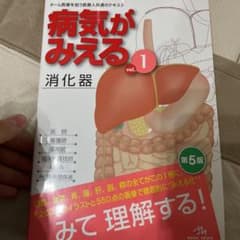 病気がみえる vol.1 消化器のサムネイル