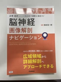 脳神経画像解剖ナビゲーションのサムネイル