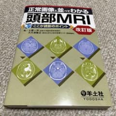 正常画像と並べてわかる頭部MRI : ここが読影のポイントのサムネイル
