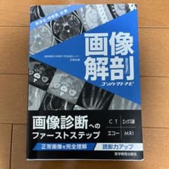 画像解剖 コンシェルジュナビのサムネイル