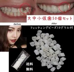 ●メルカリ便●仮歯50個セット ＆　10グラ厶　フィッテングビーズ　義歯　マウスのサムネイル