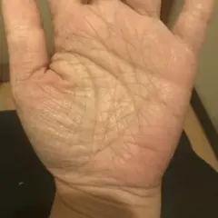 手のひらの状態　専用