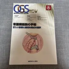 【裁断済】 OGS NOW 8 骨盤臓器脱の手術 : 正しい診断と適切な