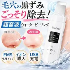 新品 ウォーターピーリング 超音波美顔器 EMS イオン導入 USB充電のサムネイル
