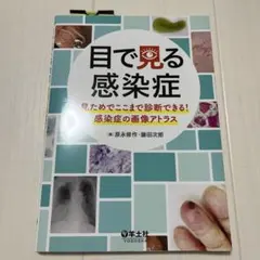 目で見る感染症 : 見ためでここまで診断できる!感染症の画像アトラス