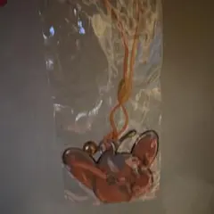 피포 군 반사경