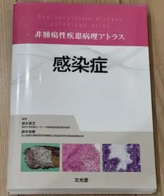 【神本】裁断済み　皮膚がんバリエーションアトラス ダーモスコピー 神本】裁断済み 皮膚がんバリエーションアトラス ダーモスコピー