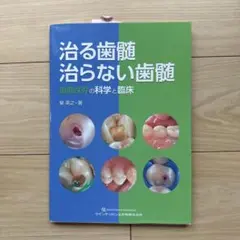 2026年最新】治る歯髄 治らない歯髄の人気アイテム - メルカリ