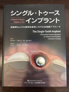 シングル・トゥース インプラント