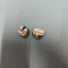 銀歯