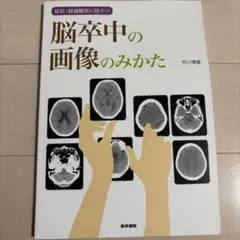 뇌졸중의 이미지의 분 의학 서원