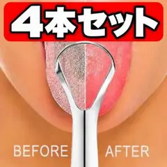 4本セット　口腔ケア✨ 舌クリーナー 舌リムーバー ステンレス製　口臭予防